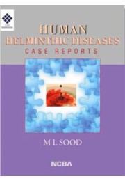 HUMAN HELMINTHIC DISEASES