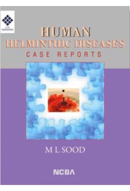 HUMAN HELMINTHIC DISEASES