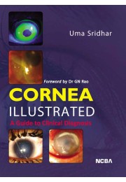 CORNEA ILLUSTRATED%3A A GUIDE TO CLINICAL DIAGNOSIS