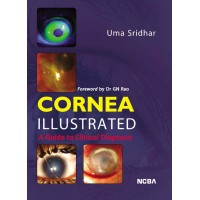 CORNEA ILLUSTRATED%3A A GUIDE TO CLINICAL DIAGNOSIS