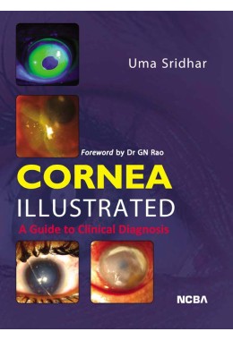 CORNEA ILLUSTRATED%3A A GUIDE TO CLINICAL DIAGNOSIS